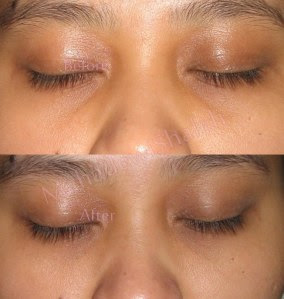 Gradual changes, please zoom