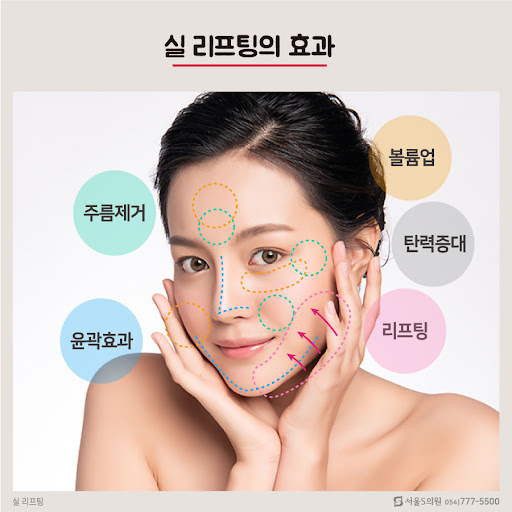 볼 처진 눈 밑의 처짐 인디언 플리츠 페이스씰 리프팅으로 유명한 청담 5G 리프팅 2개월째 정직한 리뷰