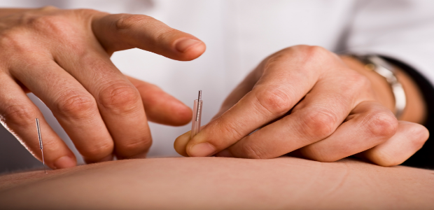 Acupuncture-For-Weight-Loss-620x300
