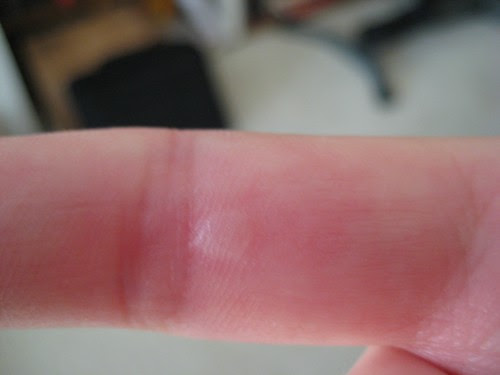 Blister