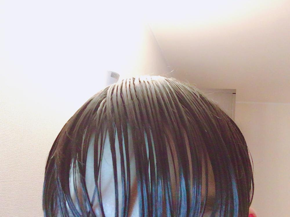 200以上 すだれ ハゲ 340250