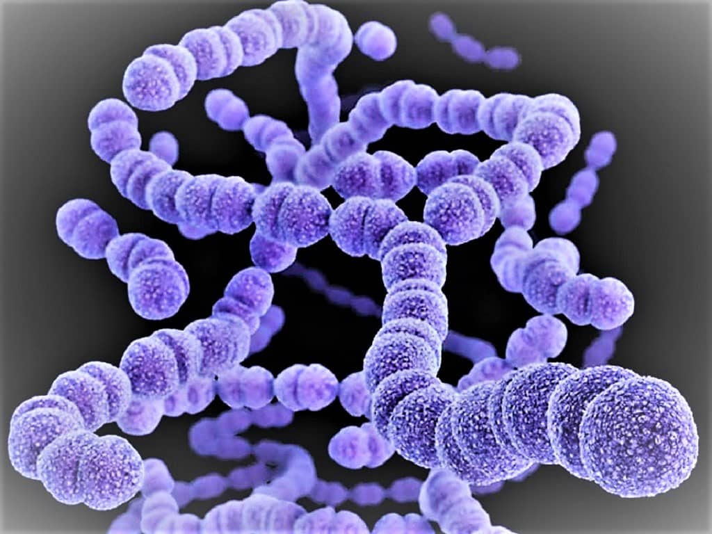 Streptococcus Pyogenes Gram Stain Reaction - slideshare