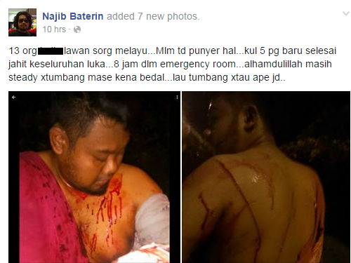 Gambar Lelaki Diserang 13 Samseng Jalanraya di Puncak Perdana