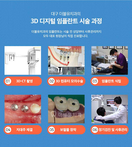 대구임플란트 치아의 기능을 상실한 경우 3