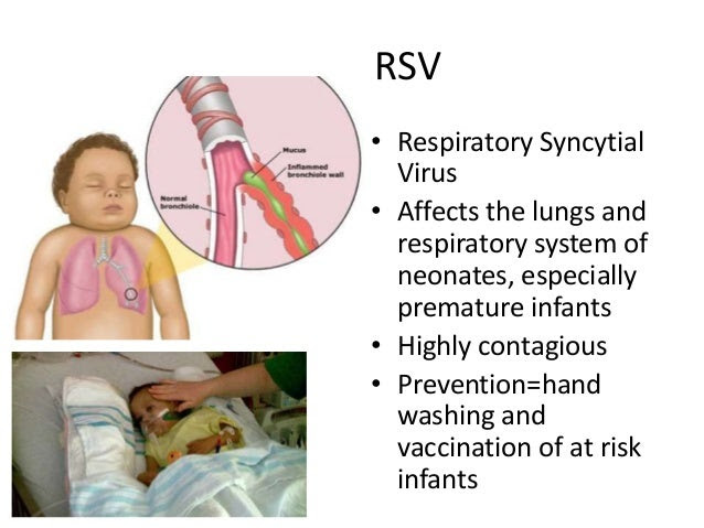 Respiratory virus