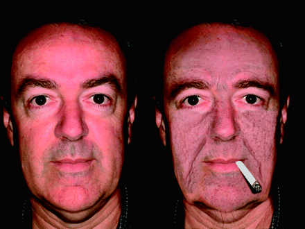 after smoking before lungs