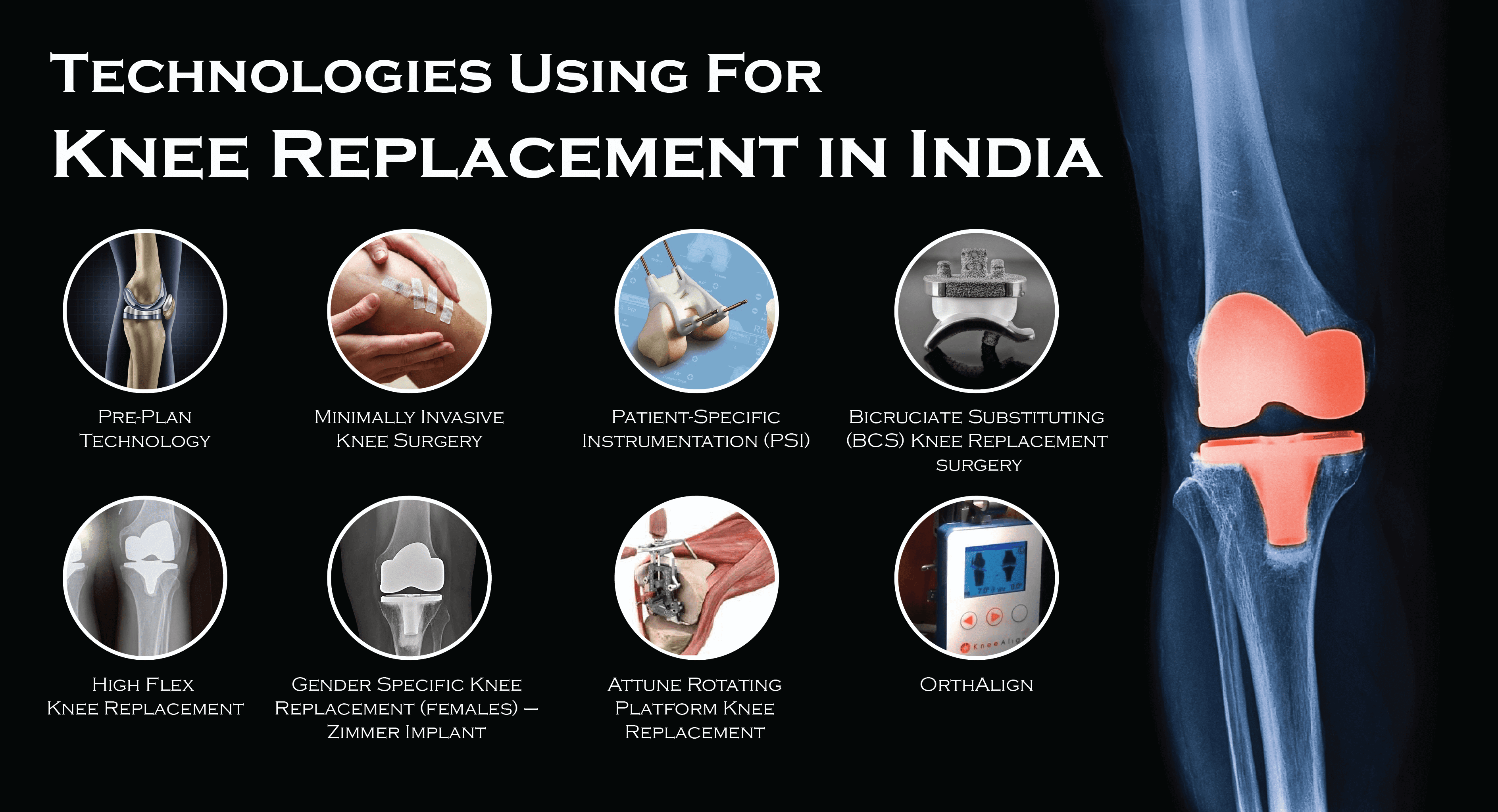 Knee Replacement Success Rate In India Rating Walls