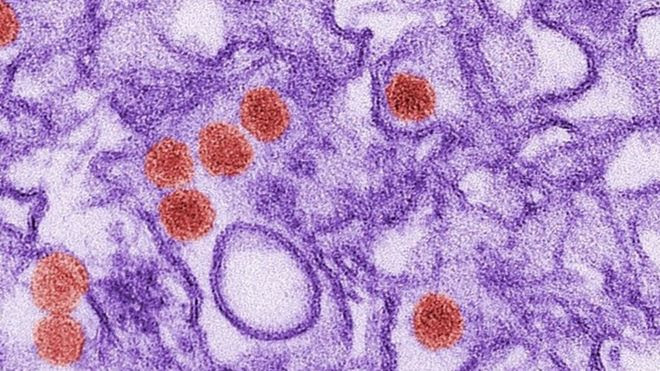 Zika virus under microscope
