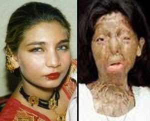 254428-pakistani-acid-attack-victim-fakhra-younus-committed-suicide-in-italy
