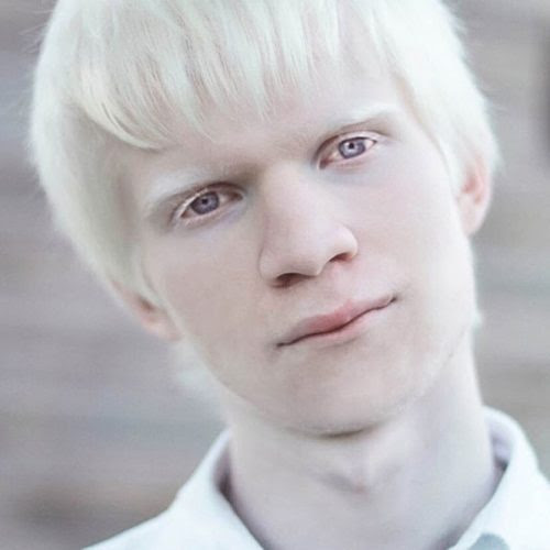 A beleza única dos albinos A beleza única dos albinos