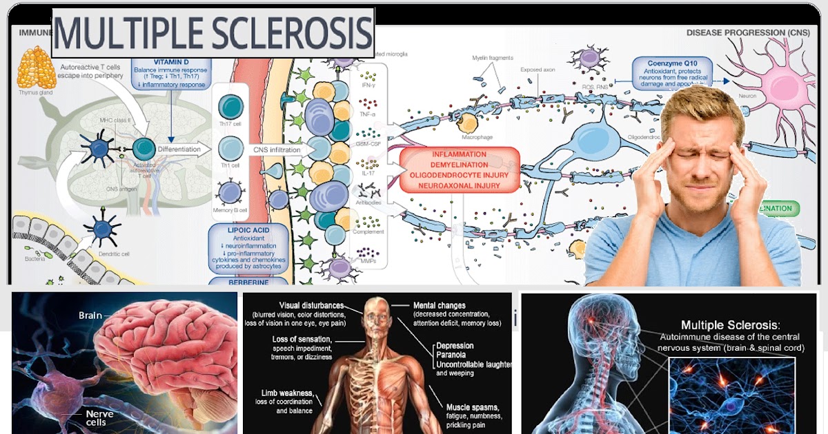 multiple-sclerosis-causes-and-treatment