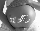 Problemas éticos relacionados con el diagnóstico prenatal no invasivo