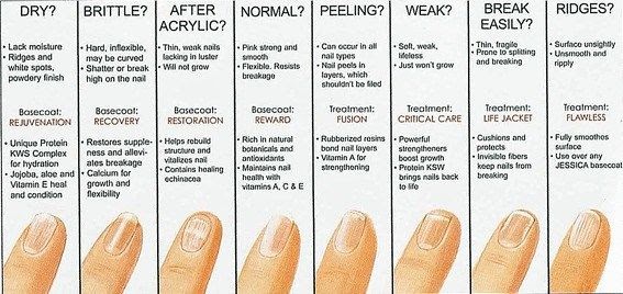 What Does the Color of Your Nails Say About Your Health? - wide 4