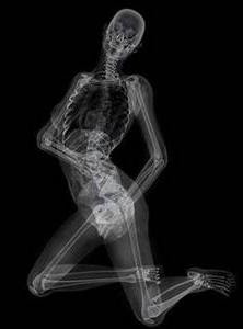 naked xray women