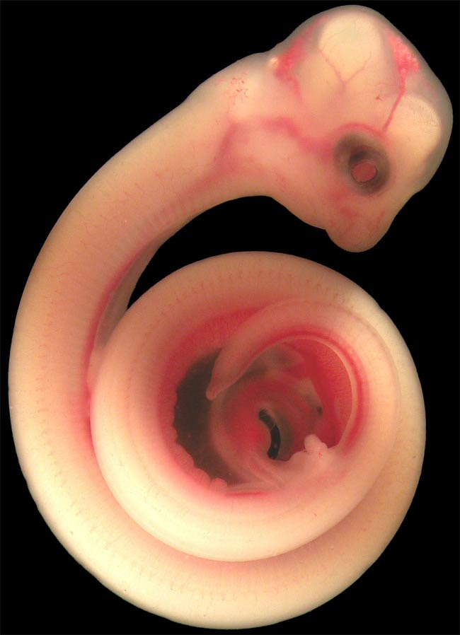 080729-Snake-Embryo-02
