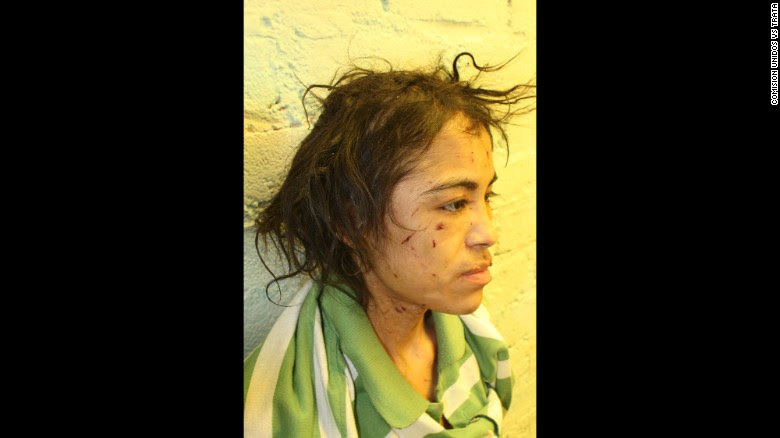 Zunduri says, in addition to being physically abused, she was also brainwashed.  The message was always the same: &quot;You&#39;re worthless.&quot; She&#39;s shown here after her escape.