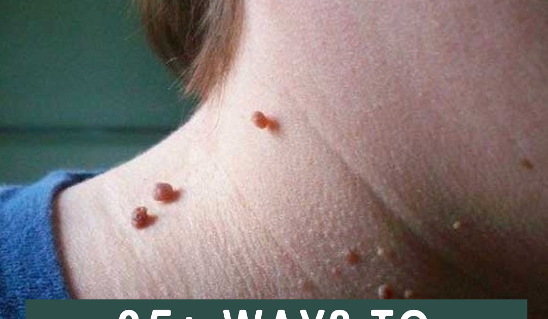 How To Remove Skin Tags From Cats HOWTOREMO