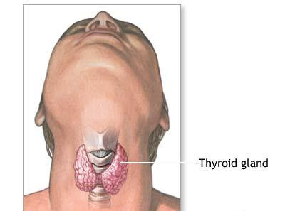 thyroidectomy thyroid gland goiter