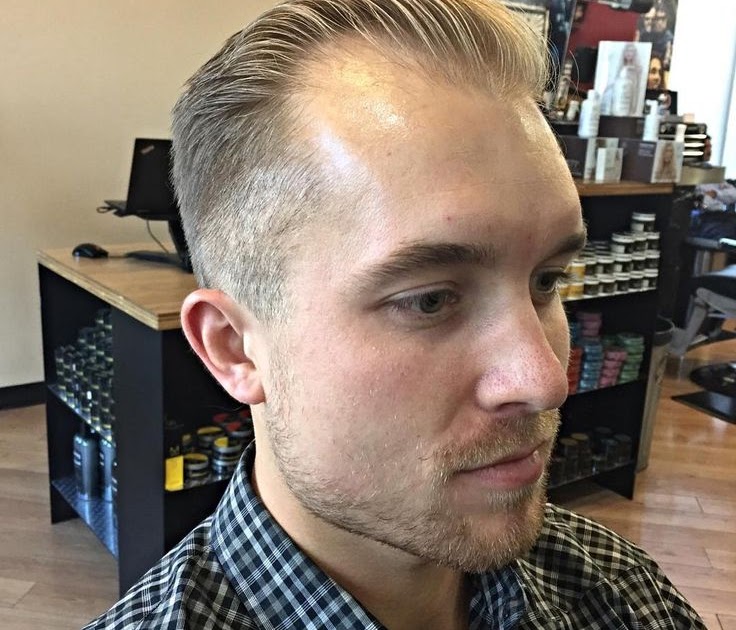Best Can Hair Grow Back After Receding for Oval Face