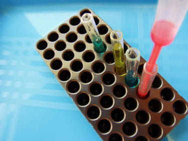 medical test tubes