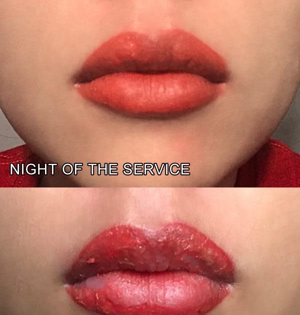 Permanent Lip Tattoo Healing Process