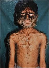 Wolf Cut Hair / The Fifth Crusade: â€œThe Crooked Kinâ€”Ustalavâ€™s