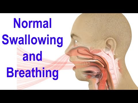 Normal Swallowing and Breathing... And What Happens With a Trach ...