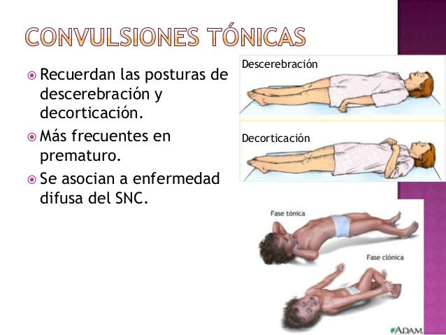 Decorticacion