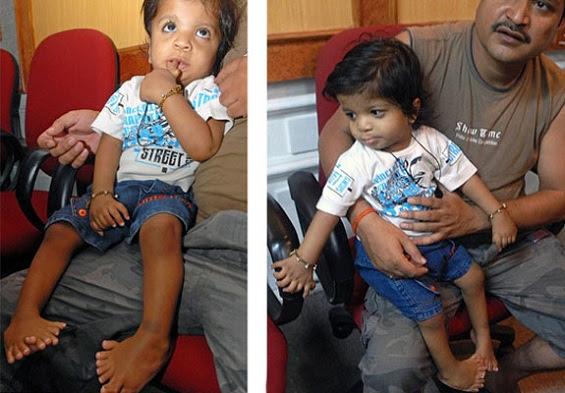 Pequeno Akshat Saxen, de 1 ano. Pequeno Akshat Saxen, de 1 ano.
