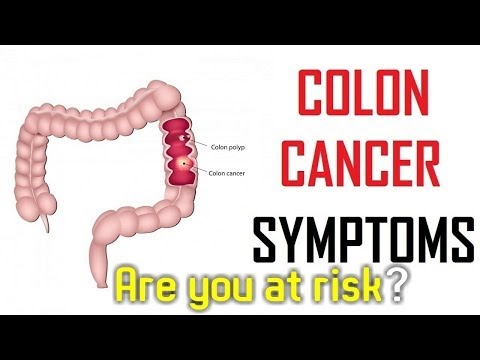 Medical Animation Videos Library: Symptoms of Bowel Cancer To Be Aware ...