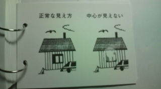 中心暗点のサンプル.jpg