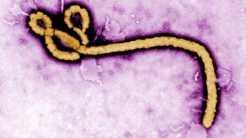 PHOTO: In this handout from the Center for Disease Control, a colorized transmission electron micrograph of a Ebola virus virion is seen. 