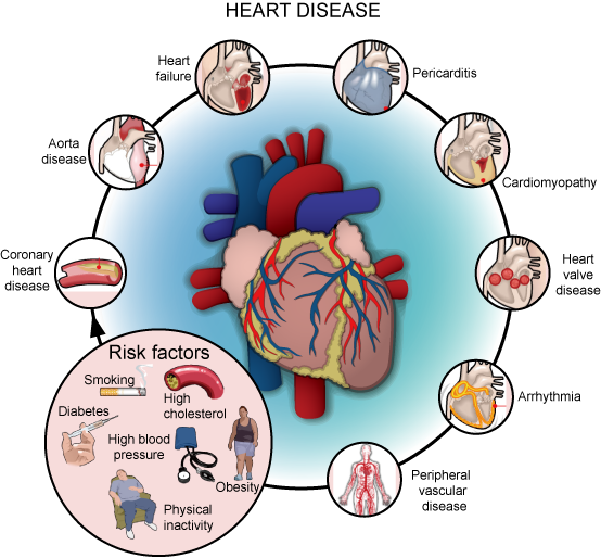 Heart Disease & its Types
