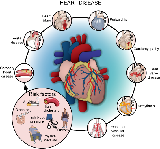 heart-disease-its-types