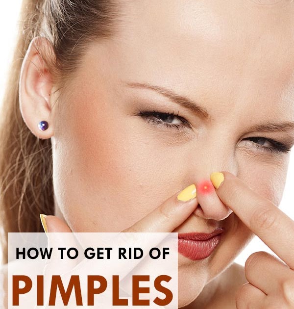 How To Get Rid Of Pimples On My Nose Fast - Mang Temon