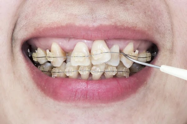 Dente Encavalado Feio - Unpredictable Wallpaper