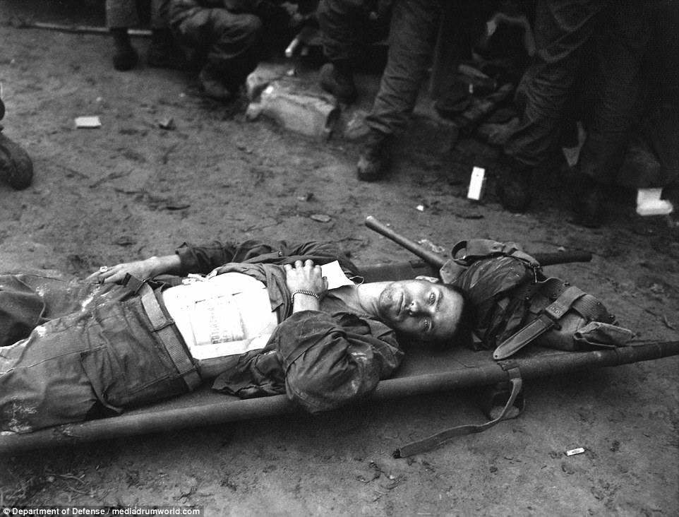 Injured US soldier Thomas Conlon, from the 21st Infantry Regiment, lies on a stretcher at a medical aid station after being wounded while crossing the Naktong River in Korea