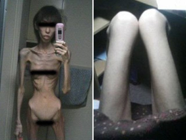 The woman from Japan who weighs 2 stone The woman from Japan who weighs 2 stone