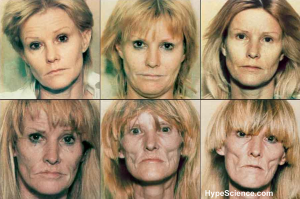 usuária de drogas pesadas durante os anos