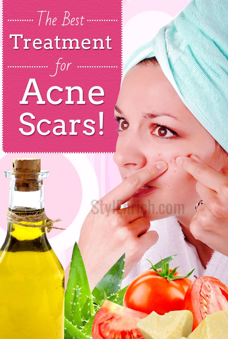 Treatment for acne scars
