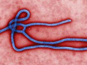 Vírus Ebola (Foto: CDC)