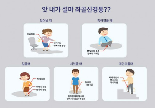좌골신경통 치료방법과 효과적인 스트레칭 방법