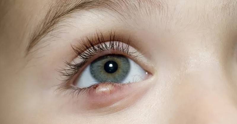 Bawah Mata Kiri Bergerak - Kening Kiri Bergerak Petanda Apa Ya Ceritera