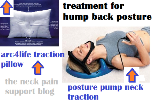 Is it possible to get rid of the hump on my neck? by NeckPainRelief