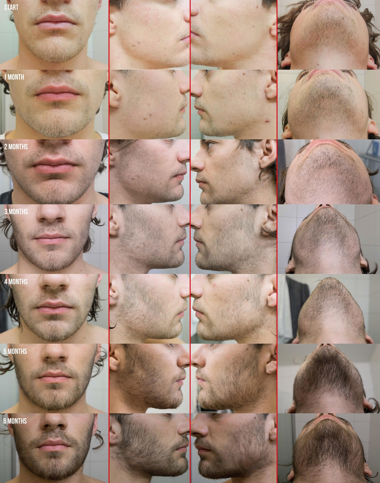 Minoxidil Before And After Beard Result - How Long Does Minoxidil Take