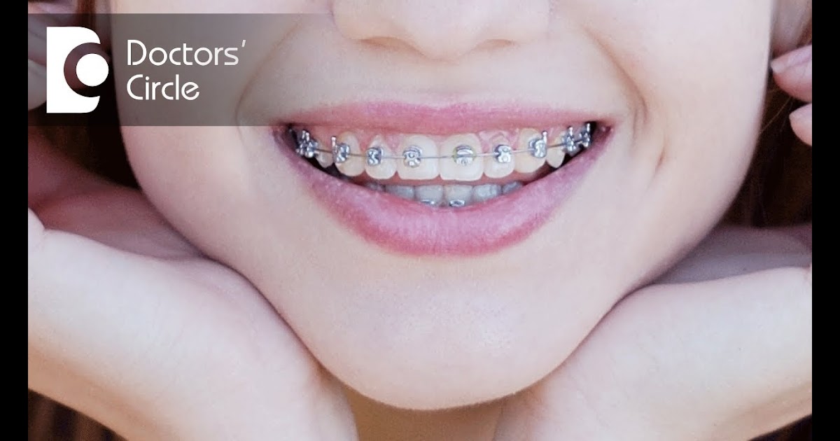 children clothing Baby Upper Teeth Gap