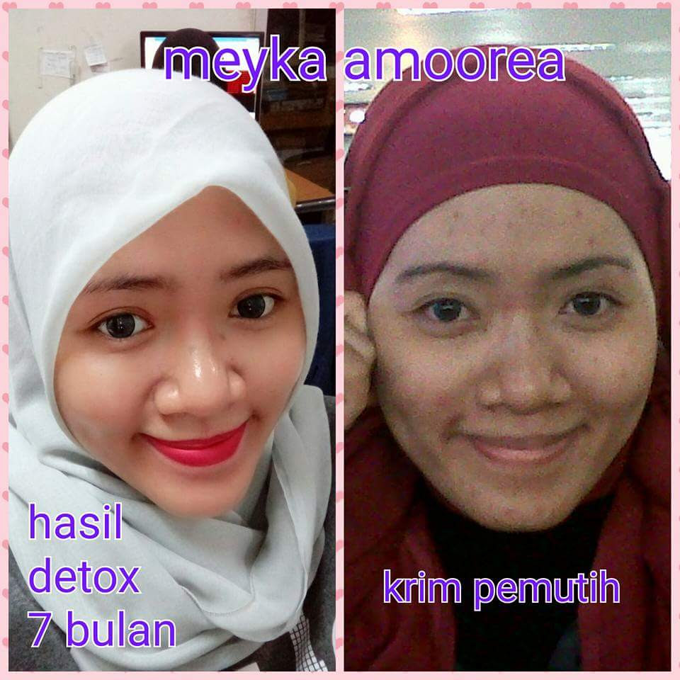 Foto Testimonial Pemakaian Amoorea Foto Testimonial Pemakaian Amoorea