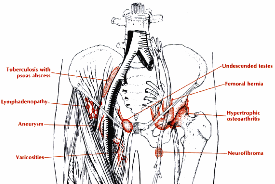 Diagram Of Male Groin Area Which Lymph Nodes Are Located