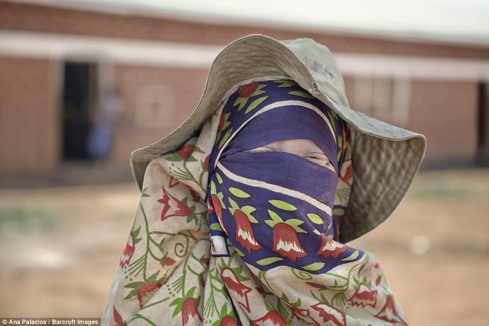 Zawia Kasim, 12, keeps well covered to protect her vulnerable skin from sunlight, although it is one of the few places were she will be able to get medical help for any damage suffered
