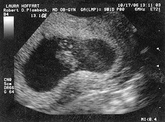 ultrasound2